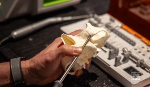 Clinician performing zygomatic implant training on a skull model