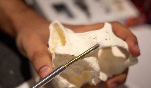 An attendee places a zygomatic implant in a dry hands-on model.