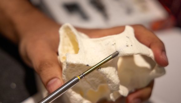 An attendee places a zygomatic implant in a dry hands-on model.