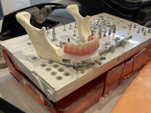 CHROME GridedSmile stackable guide hands-on model