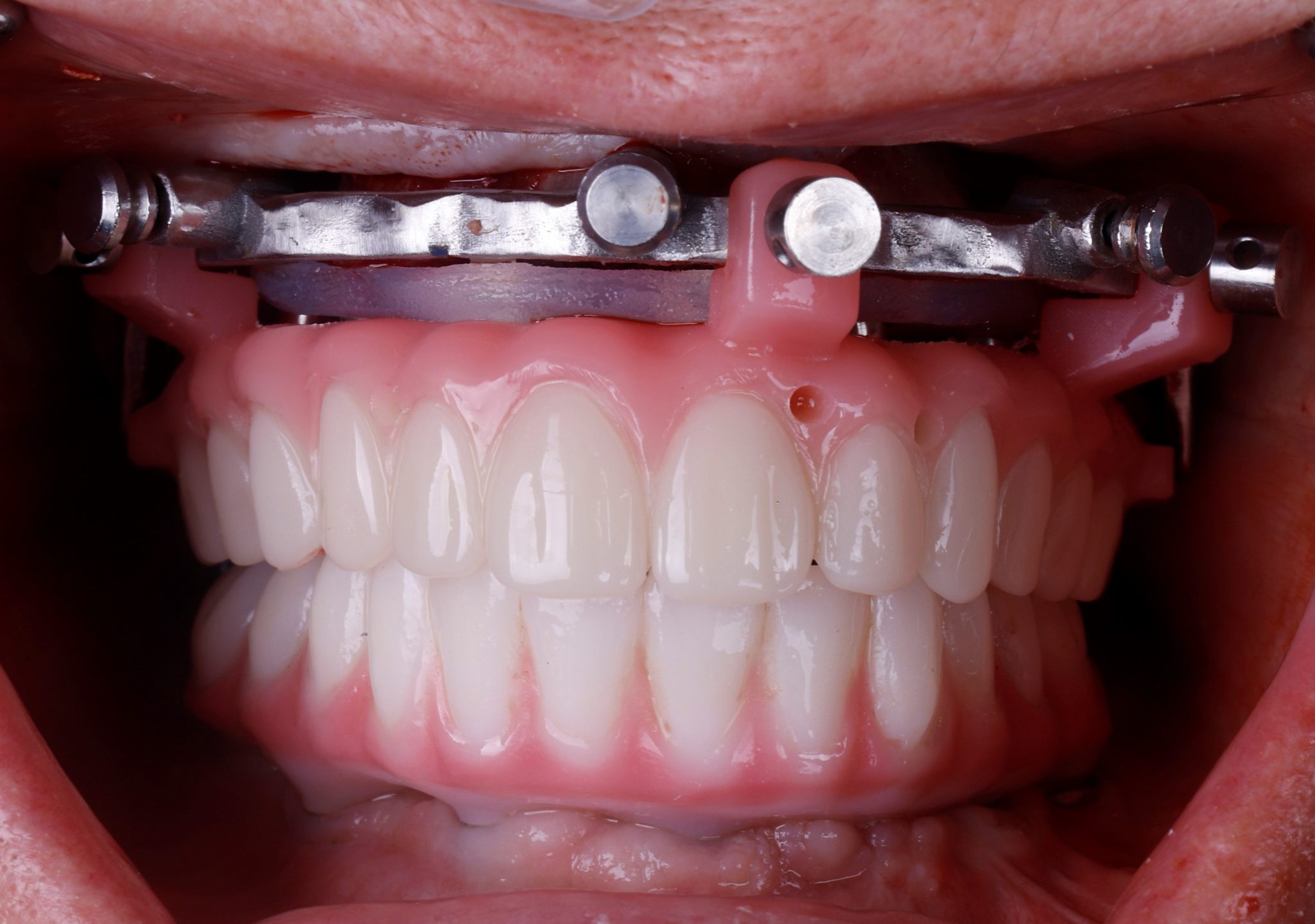 Guided TeethXpress course led by Dr. Curry Leavitt in Las Vegas